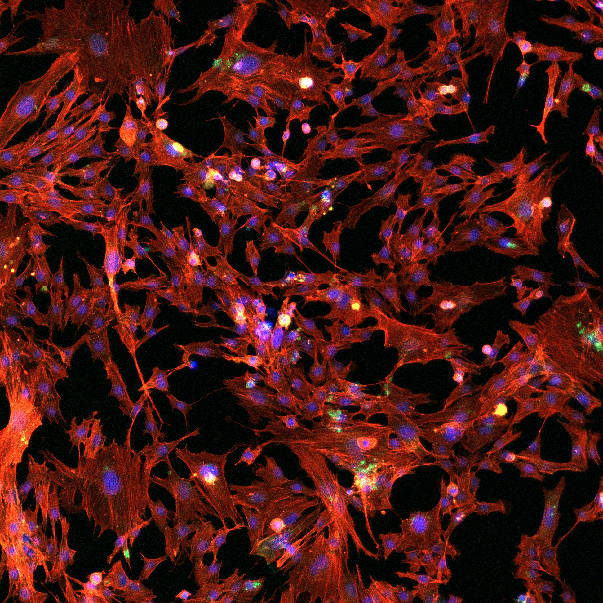 New Bioprinting Milestone Achieved